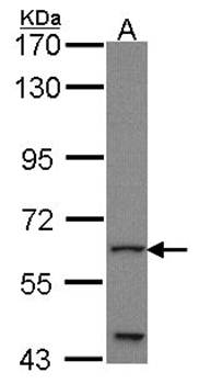 GLIS1 antibody