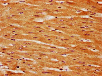 GLIS2 Antibody