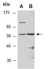 GLIS2 antibody