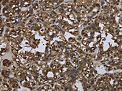 GLO1 Antibody