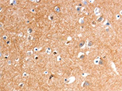 GLP1R Antibody