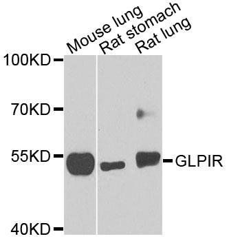 GLP1R antibody