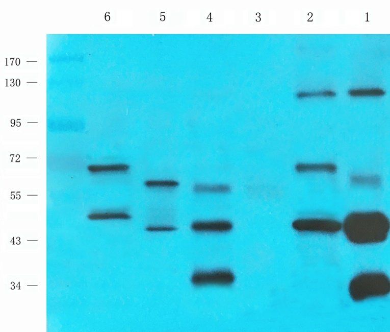 GLP2 antibody