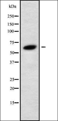 GLP2R antibody