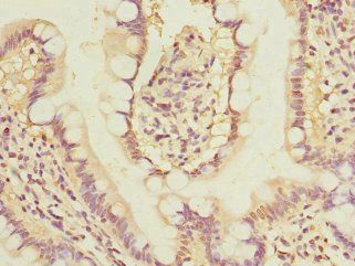 GLP2R Antibody
