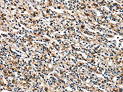 GLP2R Antibody