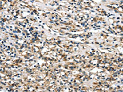 GLP2R Antibody
