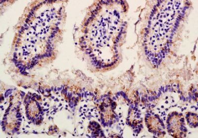 GLP2R Rabbit Polyclonal Antibody