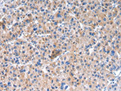 GLRA1 Antibody