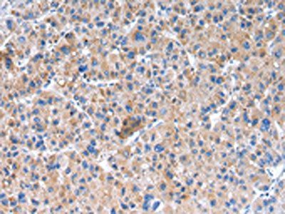 GLRA1 antibody