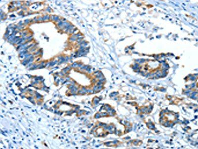 GLRA1 Antibody