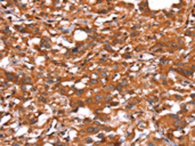 GLS Antibody