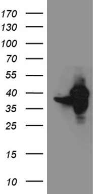 GLS2 Antibody