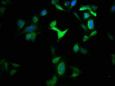 GLS2 antibody