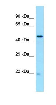 GLTSCR2 antibody