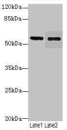 Glucagon-like peptide 1 R antibody