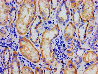 NR3C1 Antibody