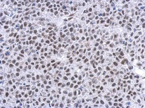 Glucocorticoid Receptor antibody