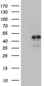 Glucocorticoid Receptor (NR3C1) antibody
