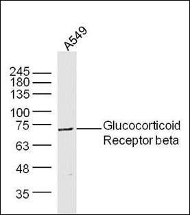 Glucocorticoid Receptor beta antibody
