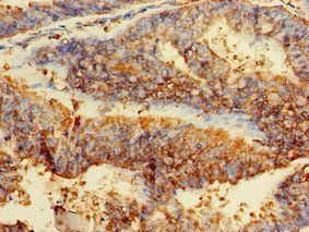 GPI Antibody