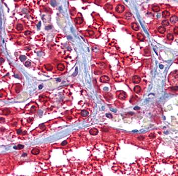 Glucose-6-phosphate isomerase Antibody