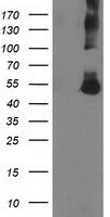 Glucose Transporter 5 GLUT5 (SLC2A5) antibody