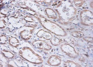 PRKCSH Antibody