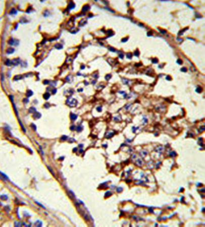 GLUL Antibody (N-term)