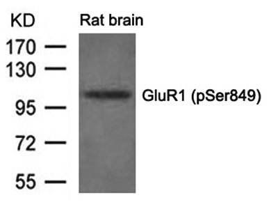 GluR1 (phospho-Ser849) Antibody