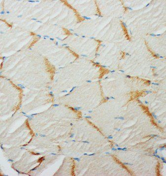 Anti-Glucose Transporter GLUT4/SLC2A4 Antibody