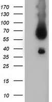 Glutamine Synthetase (GLUL) antibody