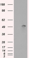 Glutamine Synthetase (GLUL) antibody