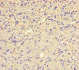 QPCT Antibody