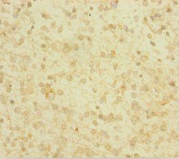 GLRX Antibody