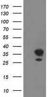 Glutathione S Transferase theta 2 (GSTT2) antibody