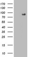 Glutathione S Transferase theta 2 (GSTT2) antibody