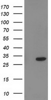 Glutathione S Transferase theta 2 Antibody