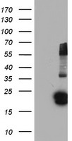 Glutathione S Transferase theta 2 (GSTT2) antibody