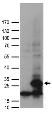 Glutathione Transferase zeta 1 Antibody