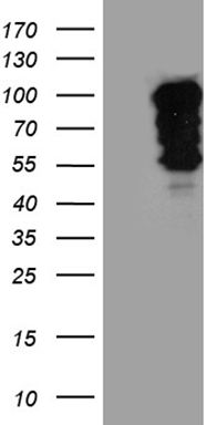 Glutathione Transferase zeta 1 Antibody