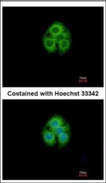 GLYATL1 antibody