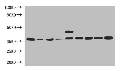 Glyceraldehyde-3-phosphate dehydrogenase antibody