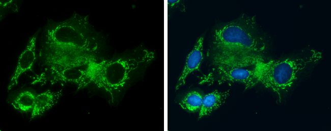 Glycine dehydrogenase antibody [N3C2-2], Internal