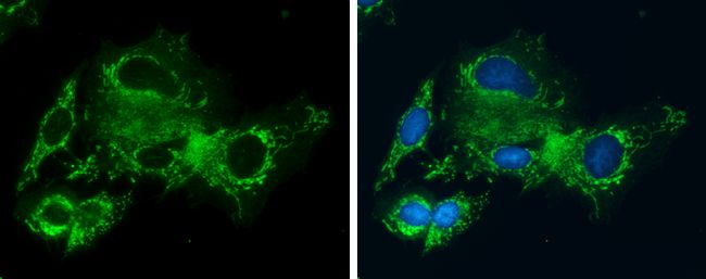 Glycine dehydrogenase antibody