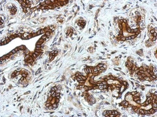 Glycine Receptor alpha 2 Rabbit Polyclonal Antibody