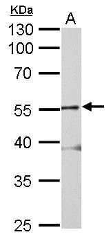Glycine Receptor alpha 2 Rabbit Polyclonal Antibody