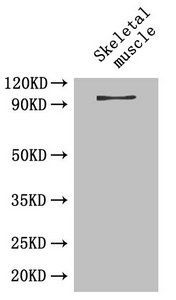 Glycogen phosphorylase, brain form antibody