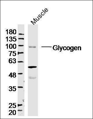 Glycogen synthase 1 antibody