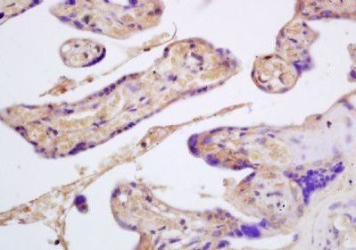 GYPB Rabbit Polyclonal Antibody